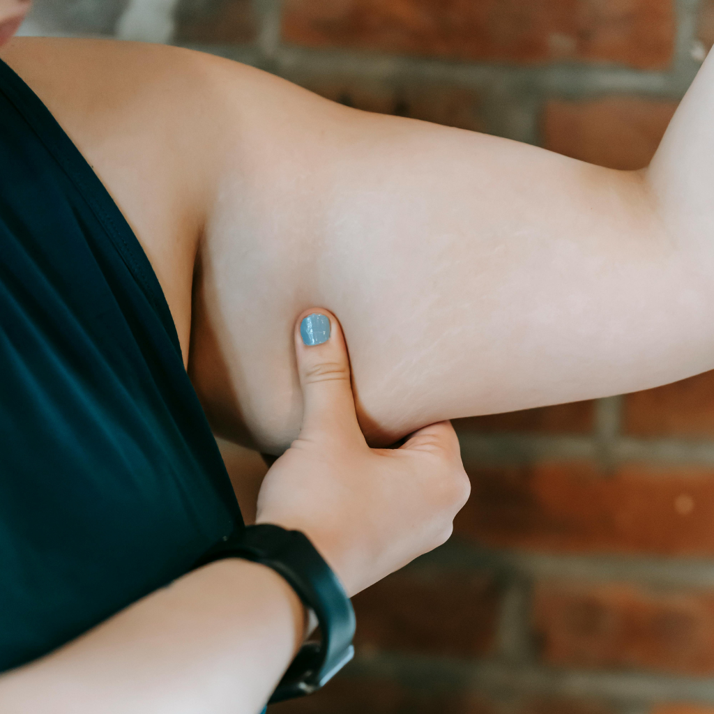 Femme mesurant la graisse sous-cutanée de son bras — perte de graisse naturelle et musculation